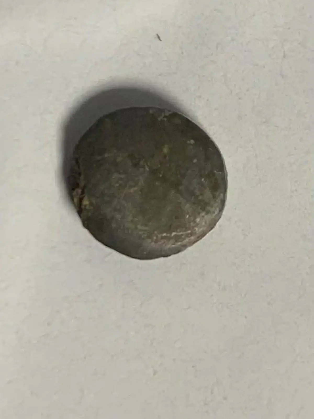 جسم معدني اخترق جسده.. تدخل جراحي دقيق ينقذ حياة طفل عمره 13 عامًا في كفرالشيخ