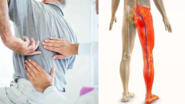 الأسباب الخفية وراء ألم الساق .. يجب حماية العمود الفقري وتعديل النشاط