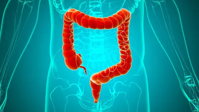التهاب القولون.. 8 أعراض تحذيرية و3 مضاعفات خطيرة