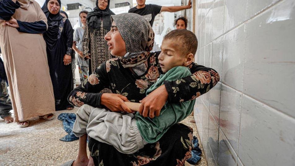 الأمم المتحدة: سوء التغذية يتفاقم بين أطفال غزة جراء هجمات إسرائيل