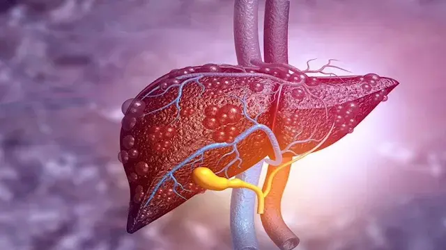 3 عادات يومية تضر الكبد.. وطرق بسيطة للحفاظ على صحته