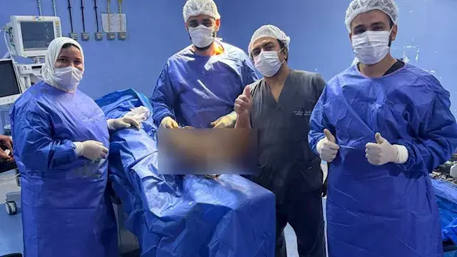 لأول مرة.. بلبيس المركزي ينجح في تثبيت كسور مضاعفة بجهاز إليزاروف (صور)