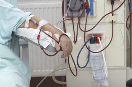 الصحة عن جلسات الغسيل الكلوي: «مينفعش المريض يجي في يوم ميلاقيش الخدمة متوفرة»