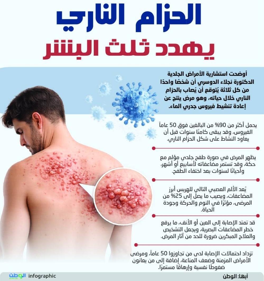 الحزام الناري يهدد ثلث البشر