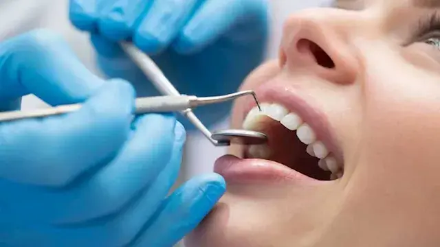 بالأرقام.. نقابة أطباء الأسنان تحذر من تداعيات زيادة أعداد الخريجين