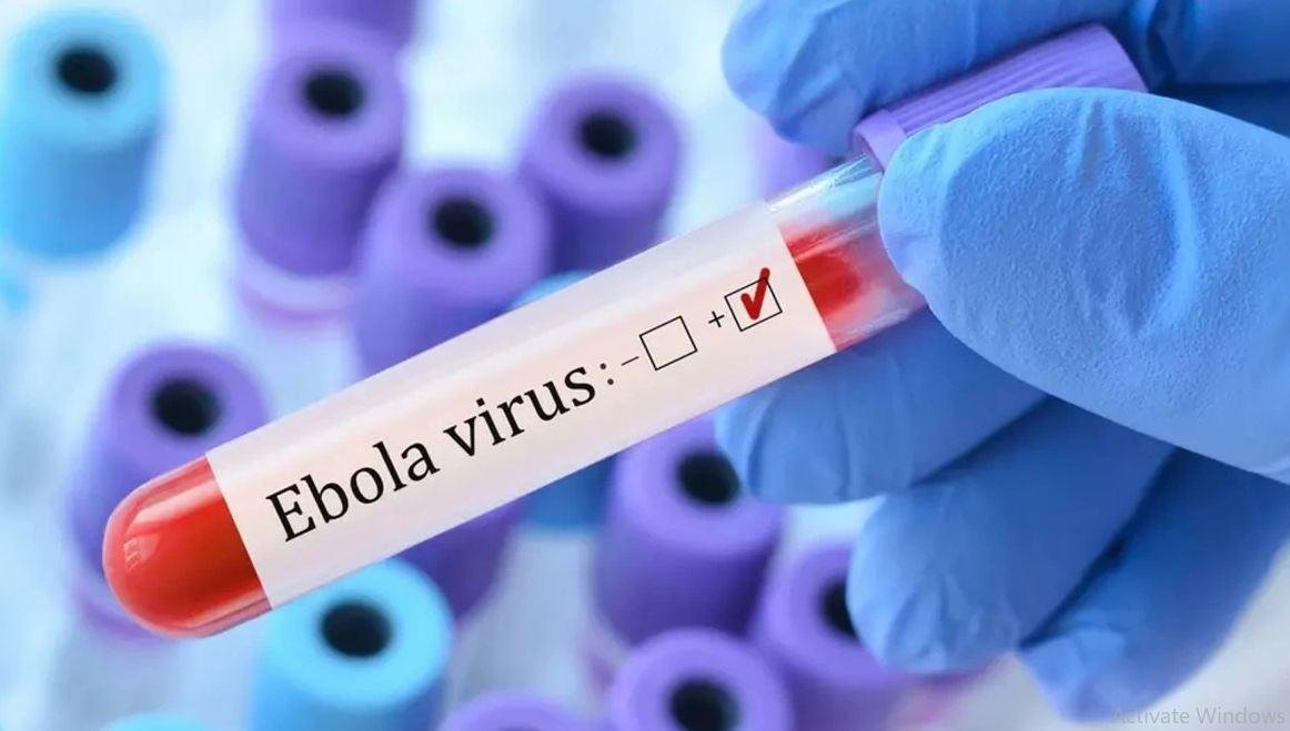 الصحة العالمية تحرز تقدما مع بدء التجارب السريرية لعلاج الإيبولا