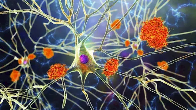 أطعمة قد تساعد على دعم الذاكرة وتحسين صحة الدماغ